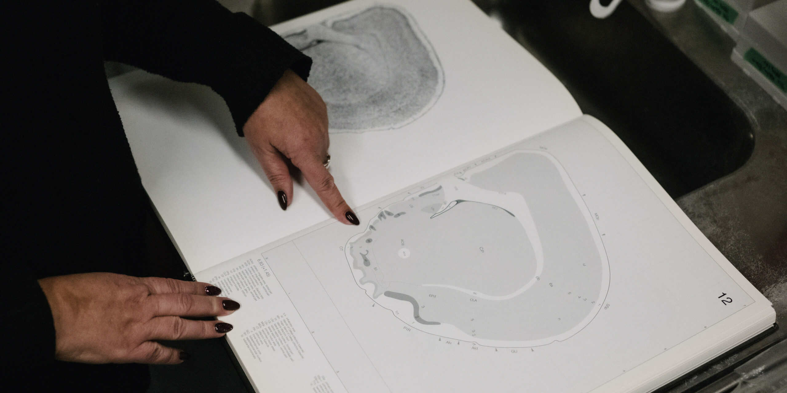 En person pekar på en hjärnavbildning i en uppslagen bok.